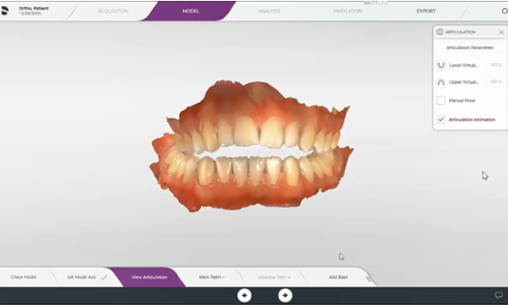 Single tooth movement with CEREC Ortho