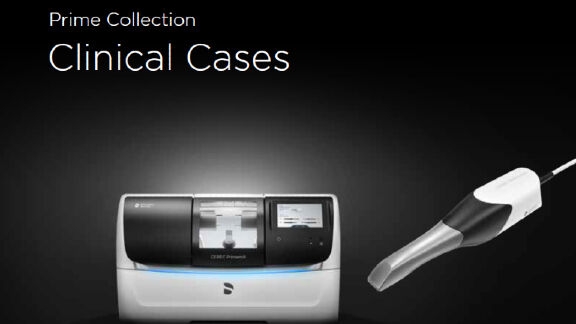 Prime Collection - Clinical Cases with CEREC
